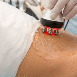 8 Sesiones Radiofrecuencia: Elimina Flacidez 1 zona