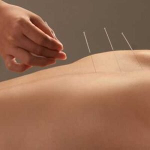 Acupuntura Corporal 60 Minutos